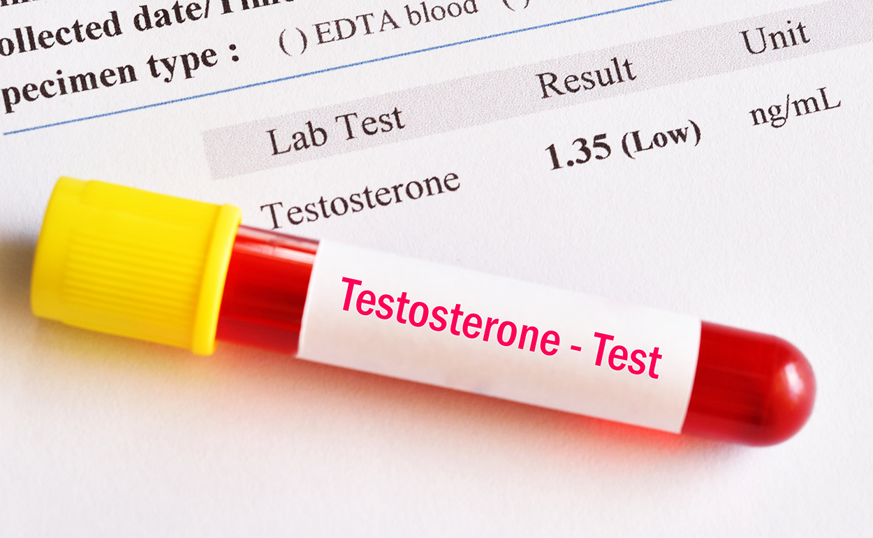 Testosterone Side Effects background image